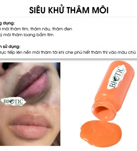 SIÊU KHỬ THÂM MÔI 2023