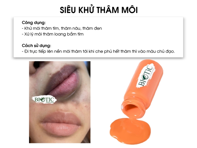 SIÊU KHỬ THÂM MÔI 2023