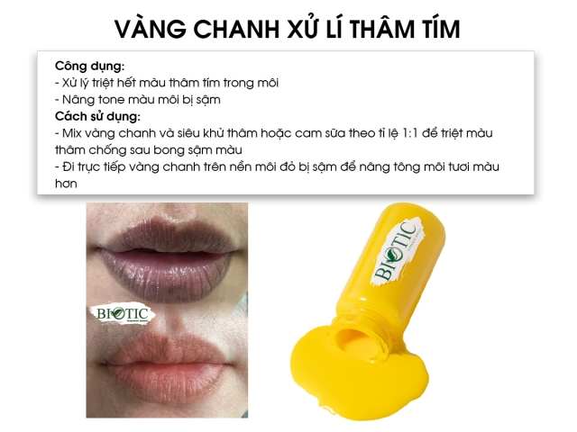 VÀNG CHANH 2023